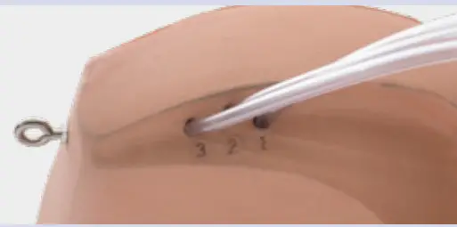 3B HEMORRHAGE CONTROL LEG TRAINER P103, P103D -FIGURE 6