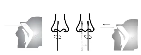 TRT-SARS-CoV-2-Antigen-Test-Kits-fig-1