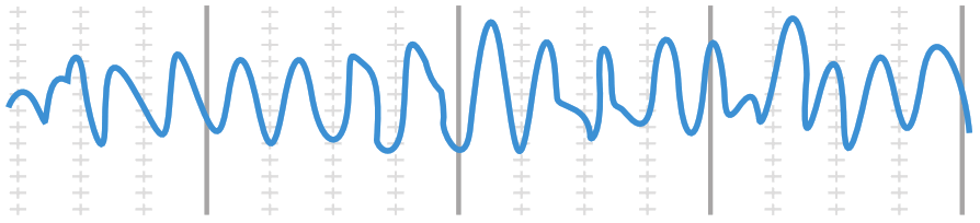 sound oasis VTS-2000 Sample Vibroacoustic Therapy System - 6