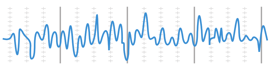 sound oasis VTS-2000 Sample Vibroacoustic Therapy System - 7