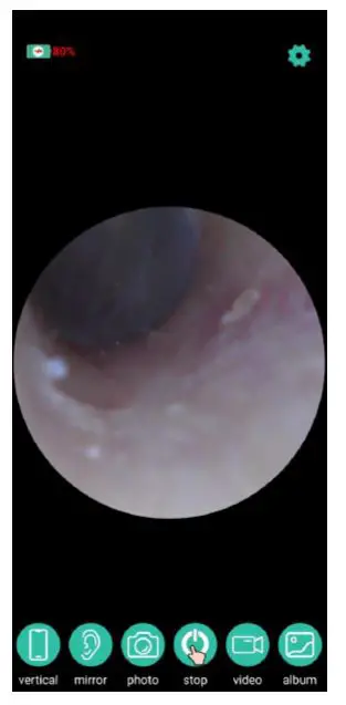 Shenzhen-Renwei-Digital-Technology-V105-Intelligent-Visual-Ceramic-Ear-Spoon-FIG5