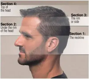FIG 1 TIPS & TECHNIQUES