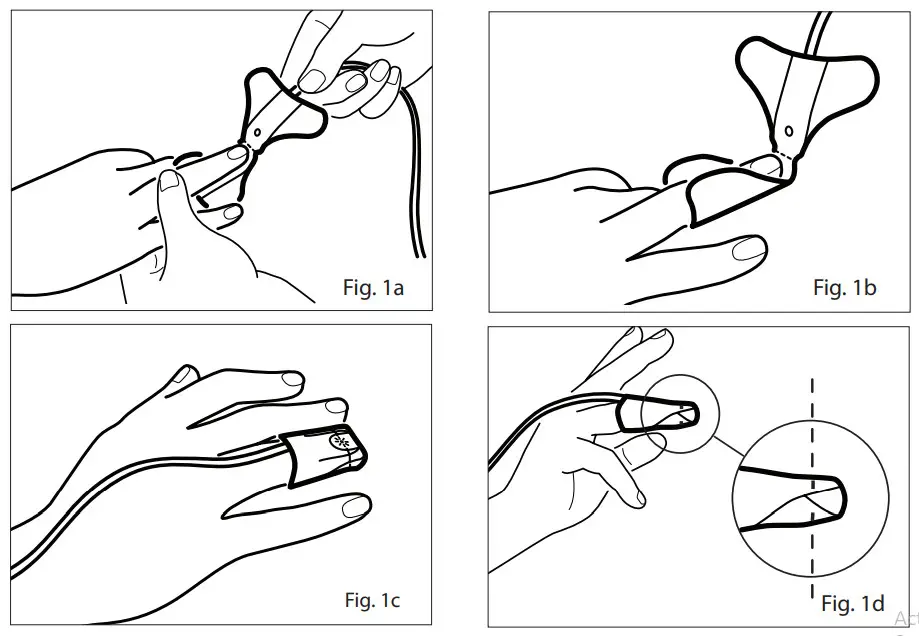 MASiMO RD SET Cabled Sensor - Sensor Series