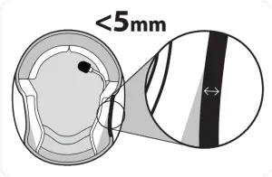 Freecom 4X - Step 5 - Option 1