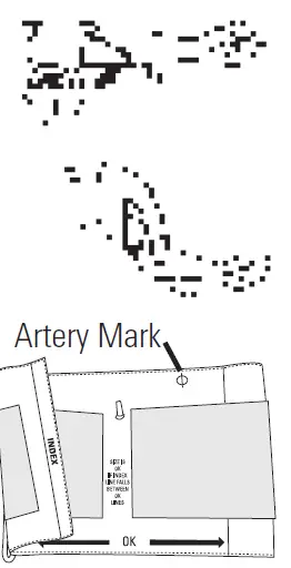 ADC-6012N-Semi-Automatic-Blood-Pressure-Monitor-12