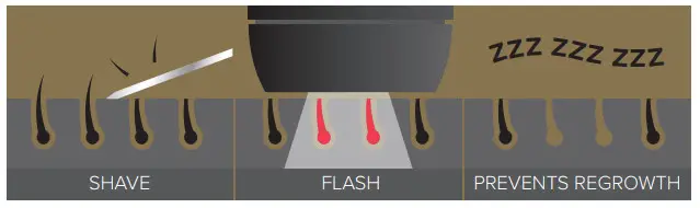 SMOOTHSKI CM12 Pure IPL Intelligent - PURE FIT WORK