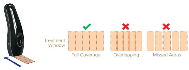 SMOOTHSKI CM12 Pure IPL Intelligent - overlap treatment pulses