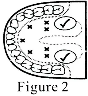 INSTANT Digital Thermometer - fig 2