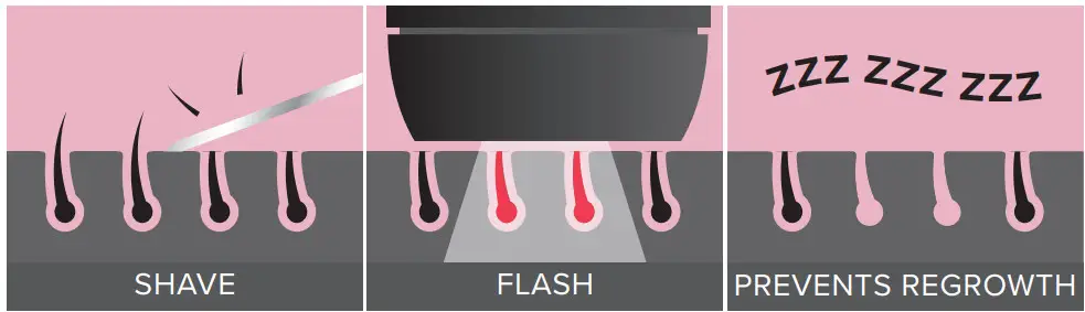 SMOOTHSKIN bare Ultrafast IPL Laser Permanent - SMOOTHSKIN