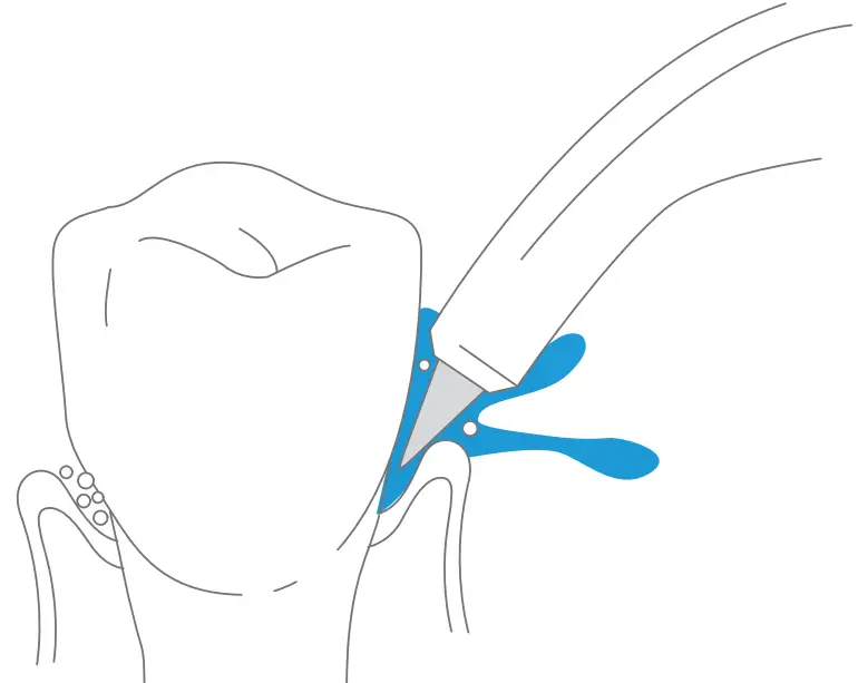 DARTWOOD B09YM2V8LX Cordless Oral Irrigator - Fig 8