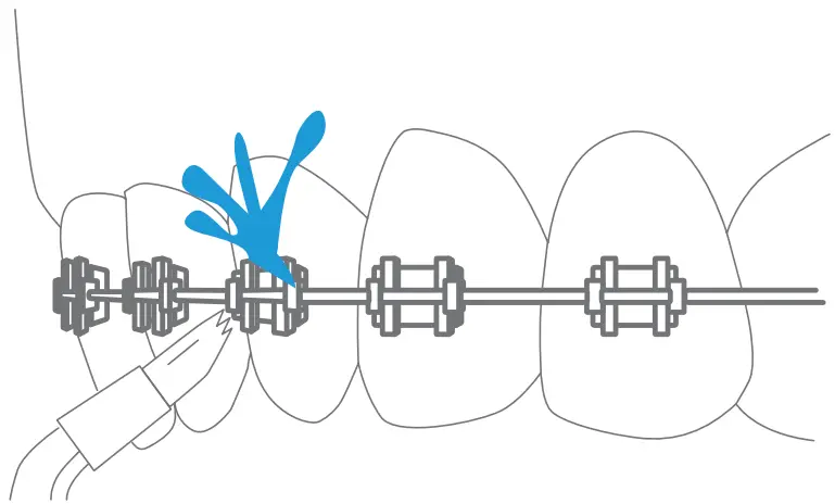 DARTWOOD B09YM2V8LX Cordless Oral Irrigator - Fig 9