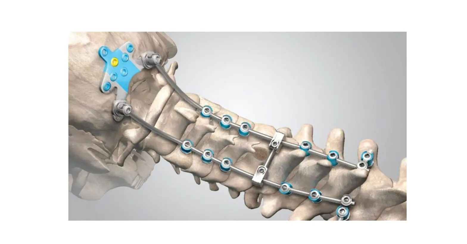 Orthofix Centurion Poct System Instructions
