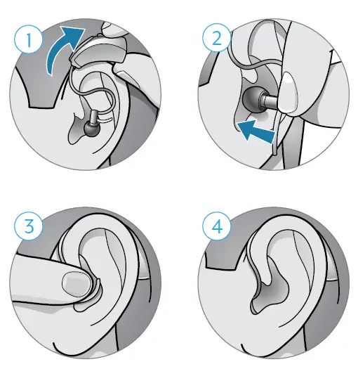 Starkey-Power-Plus-Behind-The-Ear-Hearing-Aids-fig-2