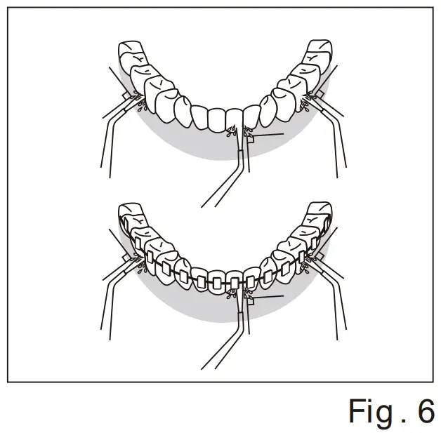 ORACURA Smart Water Flosser - Configuration 6