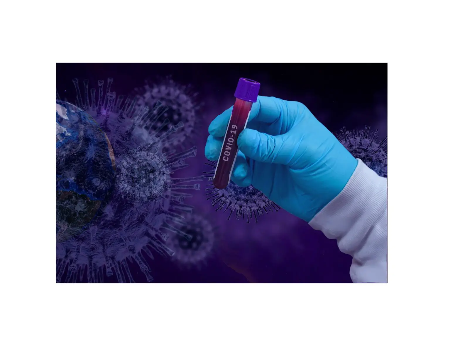 Predicine Sars-cov-2 Rt-pcr Covid-19 Collection Kit Instructions Predicine Sars-cov-2 Rt-pcr Covid-19 Collection Kit Instructions