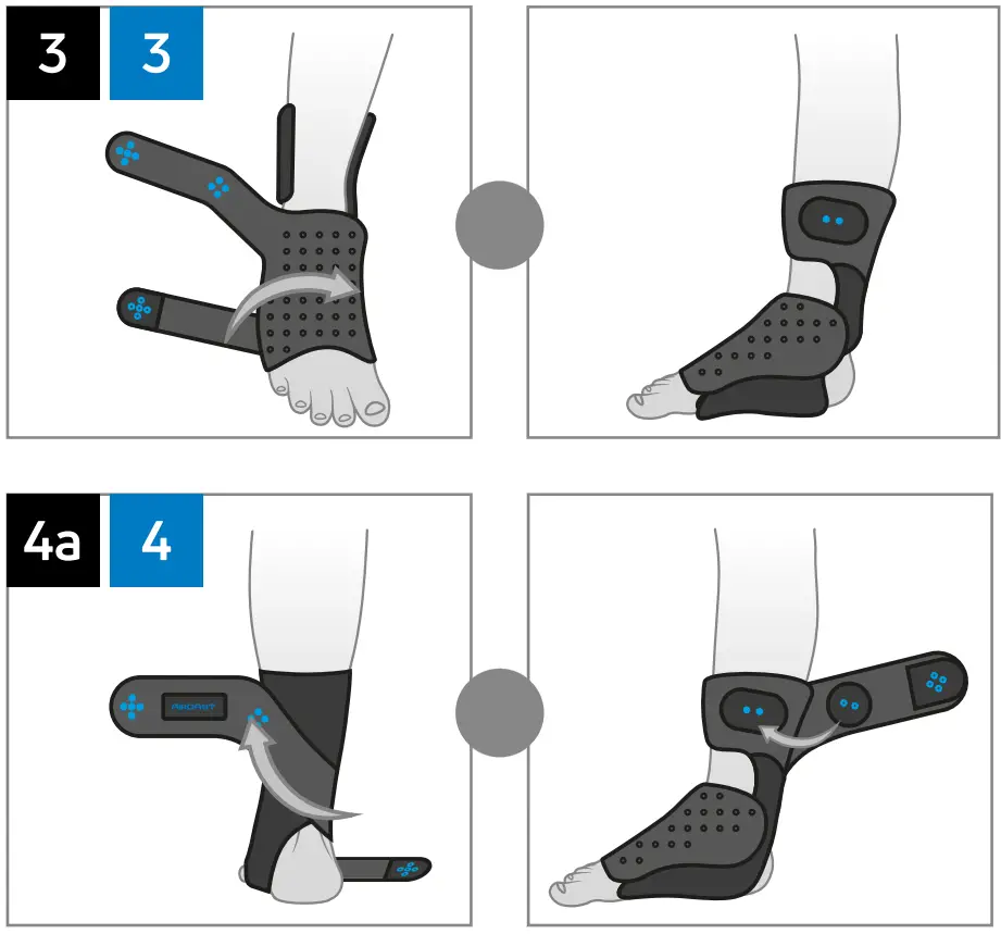 DJO AirCast Advanced Ankle Support for Sprains and Strains - FIGURE 2