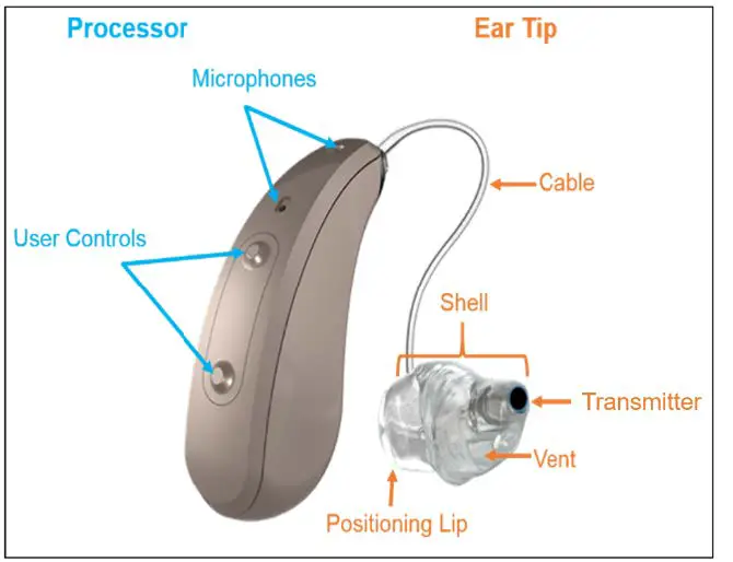 earlens IFU00038vK Contact Hearing Solution Fig3