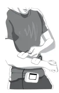 TENS Electro Medic NONA - fig 4