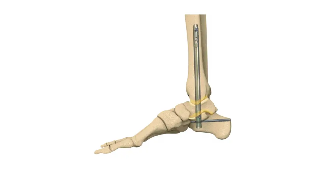 Dynanail - Ttc Fusion System Instructions
