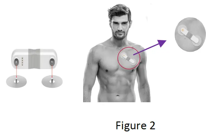 Viatom ER1 Dynamic ECG recorder fig 4