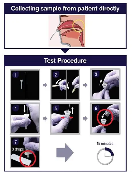MEDICAL SUPPLIES CELLTRION-CTP60-AG-COVID Celltrion DiaTrust COVID-19 AG Rapid Test-1