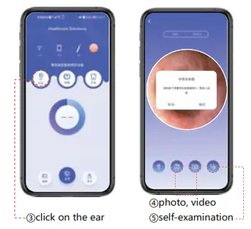 VITCOCO OS821 Visual Otoscope - fig3