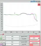 Phonak-Roger-Hearing-Aid-Microphone-05