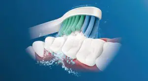 FIG 3 Philips Sonicare technology