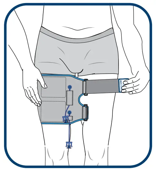 BIOWRAP Thigh and Calf - fig 11