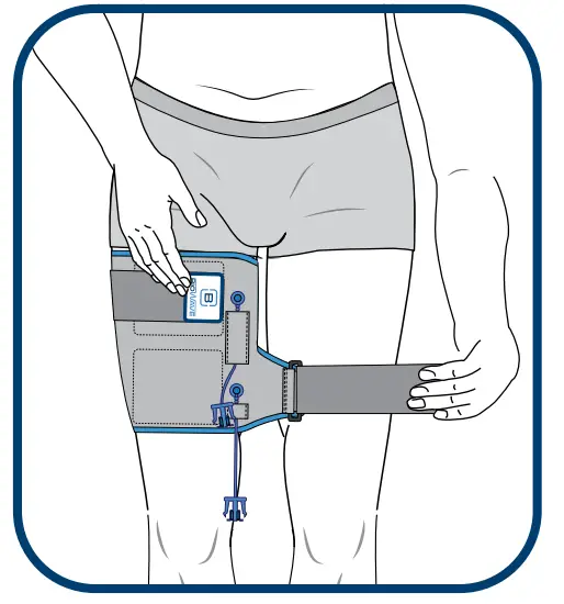 BIOWRAP Thigh and Calf - fig 12