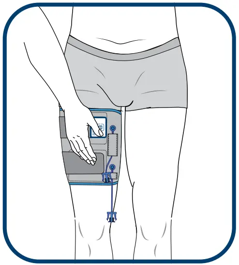 BIOWRAP Thigh and Calf - fig 13