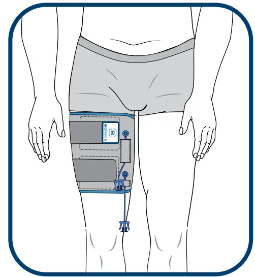 BIOWRAP Thigh and Calf - fig 14