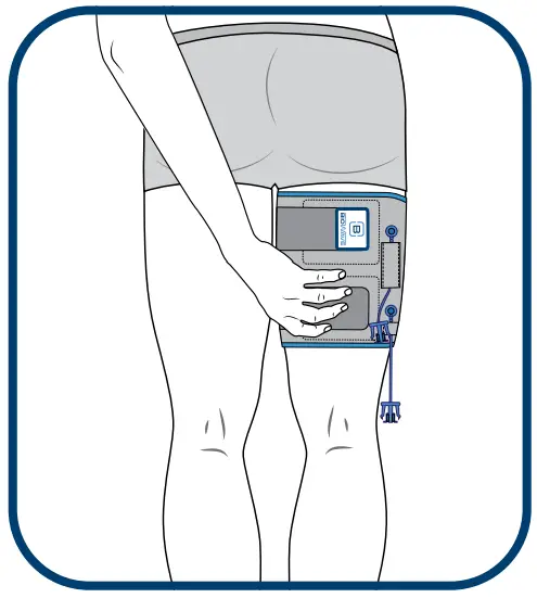 BIOWRAP Thigh and Calf - fig 7
