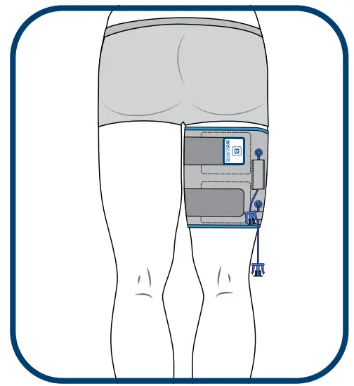 BIOWRAP Thigh and Calf - fig 8