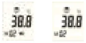 AiQURA AD801 Digital Forehead Infrared Thermometer - Setting