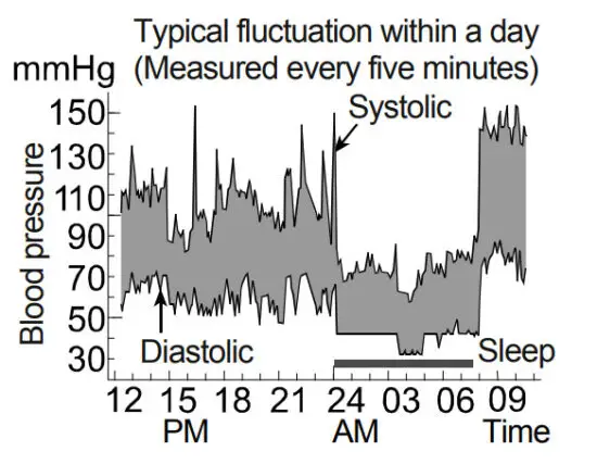 And UA 767S Digital Blood Pressure Monitor - Blood Pressure