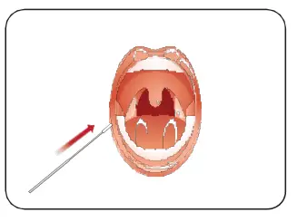 INFLUENZA-AU2032-A-B-Antigen-Rapid-Test-Kit-fig-12