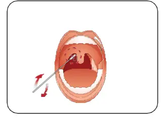 INFLUENZA-AU2032-A-B-Antigen-Rapid-Test-Kit-fig-12