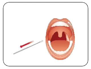 INFLUENZA-AU2032-A-B-Antigen-Rapid-Test-Kit-fig-12