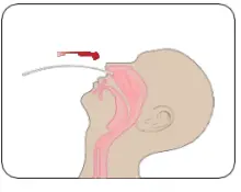 INFLUENZA-AU2032-A-B-Antigen-Rapid-Test-Kit-fig-3