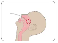 INFLUENZA-AU2032-A-B-Antigen-Rapid-Test-Kit-fig-3