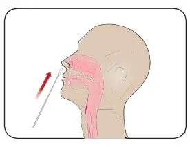 INFLUENZA-AU2032-A-B-Antigen-Rapid-Test-Kit-fig-3