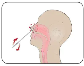 INFLUENZA-AU2032-A-B-Antigen-Rapid-Test-Kit-fig-8