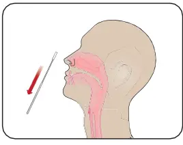 INFLUENZA-AU2032-A-B-Antigen-Rapid-Test-Kit-fig-9