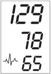 Irregular heartbeat detector