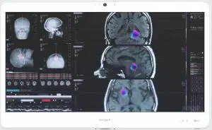 tangent AX210NG Medix 24 v2 WLAN Module