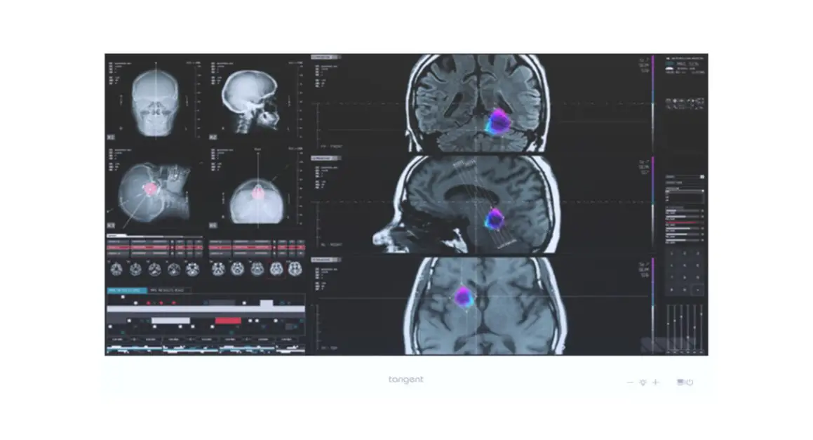 Tangent Ax210ng Medix 24 V2 Wlan Module User Guide