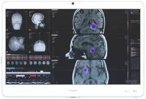 tangent AX210NG Medix 24 v2 WLAN Module - dealer