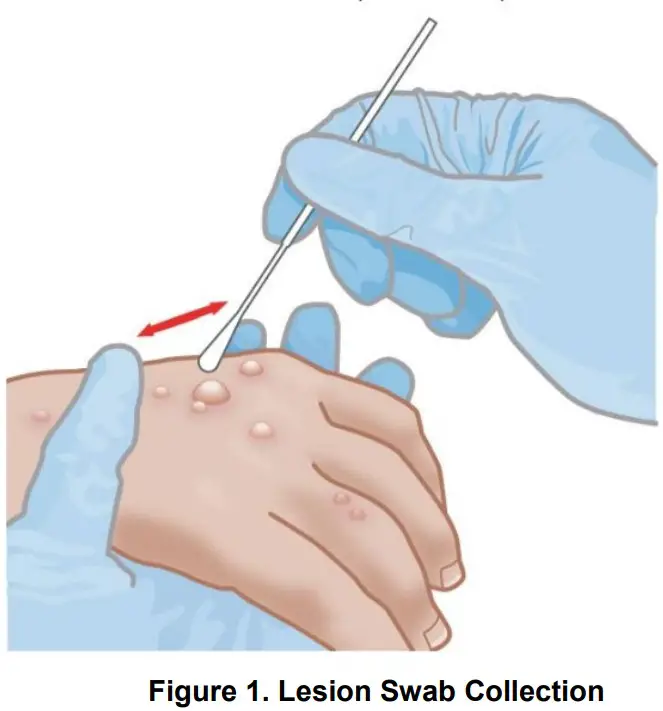 Cepheid GXMPX 10 Xpert Mpox GeneXpert Real Time PCR Test - FIGURE 1