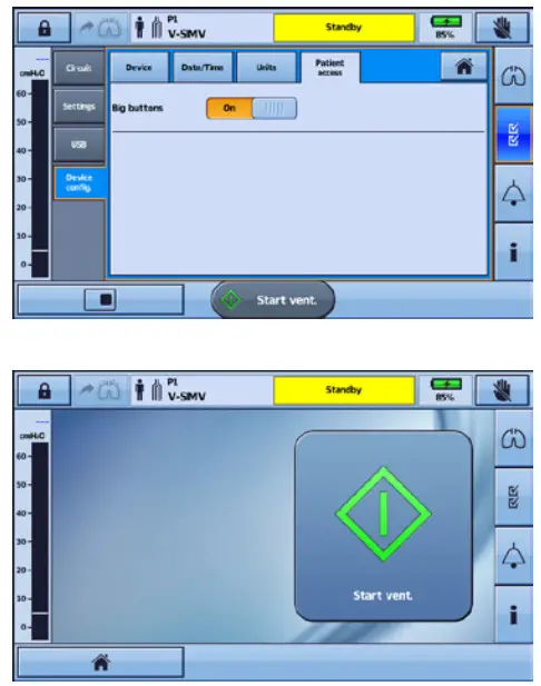 ResMed Astral 150 Life Support Ventilator- Big buttons